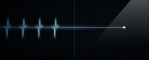 Cleveland Failure to Diagnose Heart Attack Attorney